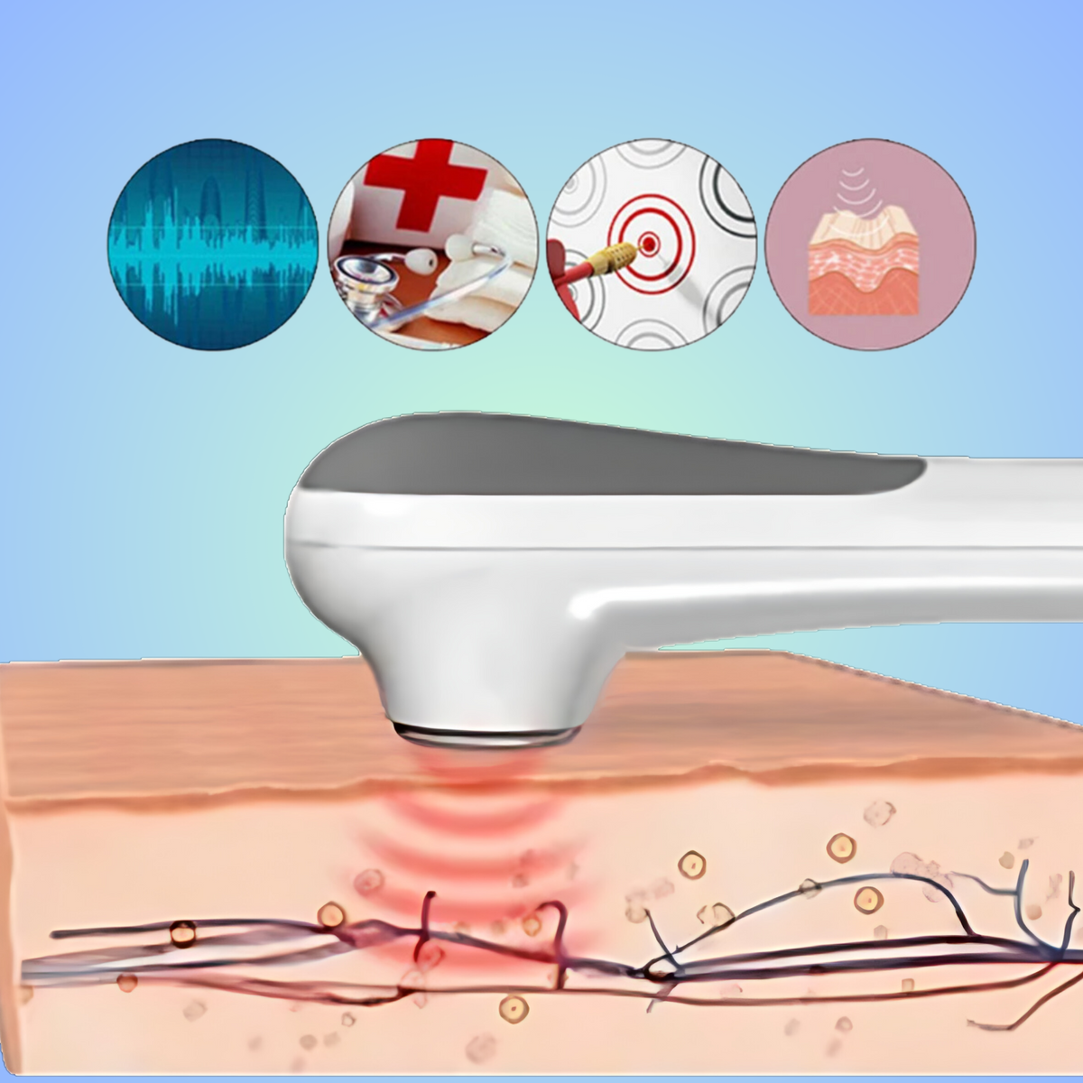 Neuropathy Ultrasound Device 2.0